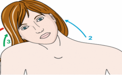Best Treatment for Functional Dystonia