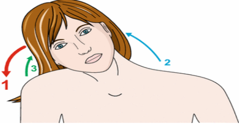Best Treatment for Functional Dystonia